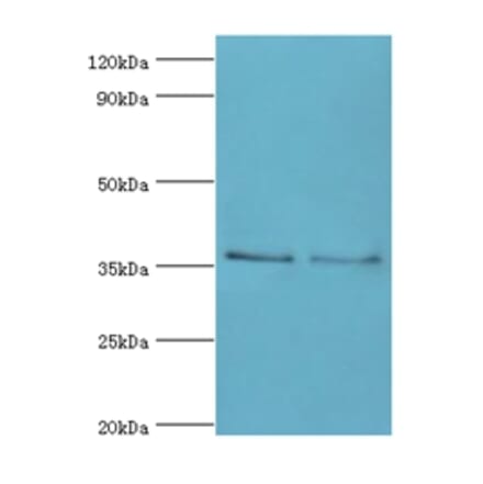 HOXA1 Polyclonal Antibody from Signalway Antibody (42210) - Antibodies.com