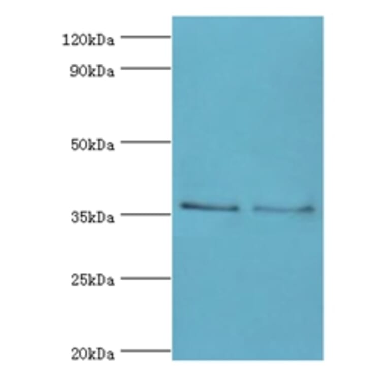 HOXA1 Polyclonal Antibody from Signalway Antibody (42210) - Antibodies.com