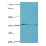 HOXA1 Polyclonal Antibody from Signalway Antibody (42210) - Antibodies.com