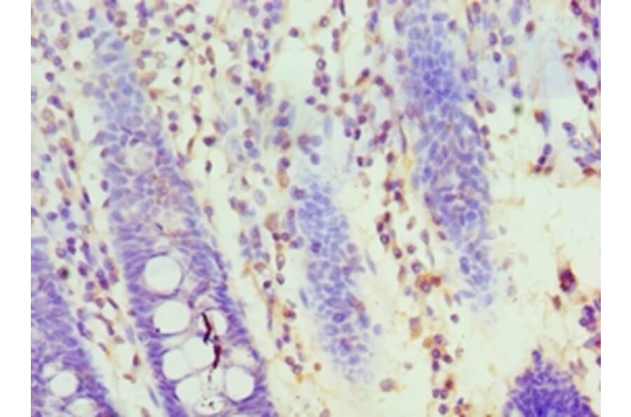 Immunohistochemistry - HOXA1 Polyclonal Antibody from Signalway Antibody (42210) - Antibodies.com