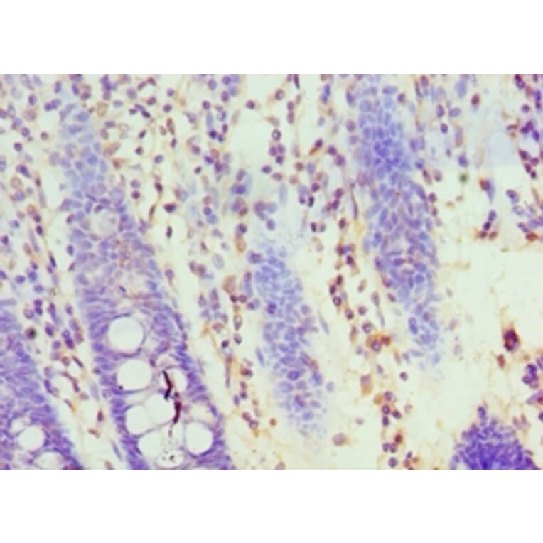 Immunohistochemistry - HOXA1 Polyclonal Antibody from Signalway Antibody (42210) - Antibodies.com
