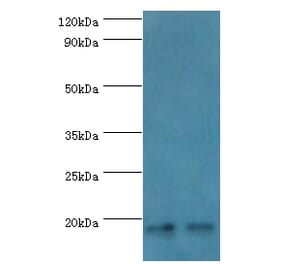 NCBP2 Polyclonal Antibody from Signalway Antibody (42267) - Antibodies.com