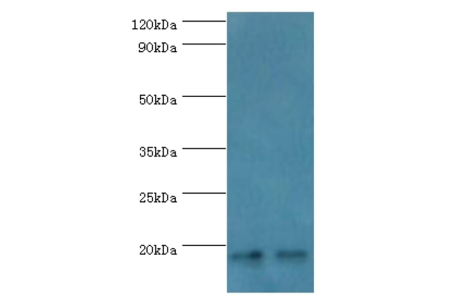 NCBP2 Polyclonal Antibody from Signalway Antibody (42267) - Antibodies.com