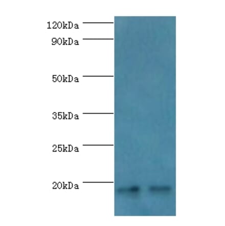 NCBP2 Polyclonal Antibody from Signalway Antibody (42267) - Antibodies.com