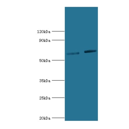 NR2C1 Polyclonal Antibody from Signalway Antibody (42274) - Antibodies.com