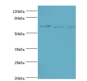 CDC16 Polyclonal Antibody from Signalway Antibody (42650) - Antibodies.com