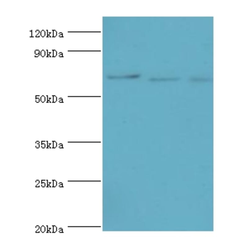 CDC16 Polyclonal Antibody from Signalway Antibody (42650) - Antibodies.com