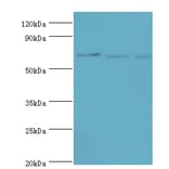 CDC16 Polyclonal Antibody from Signalway Antibody (42650) - Antibodies.com