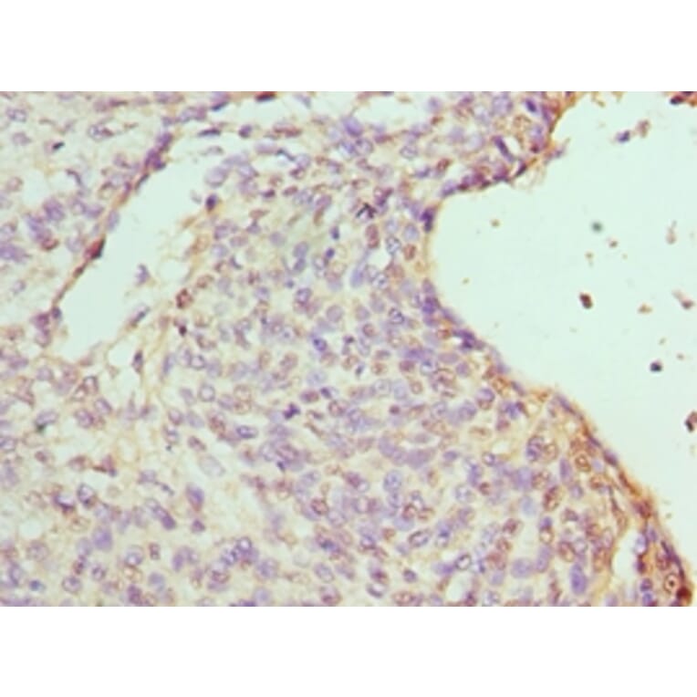 Immunohistochemistry - RBBP7 Polyclonal Antibody from Signalway Antibody (42653) - Antibodies.com