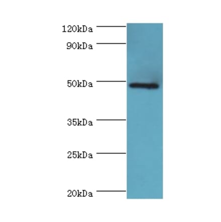 IFT57 Polyclonal Antibody from Signalway Antibody (42678) - Antibodies.com