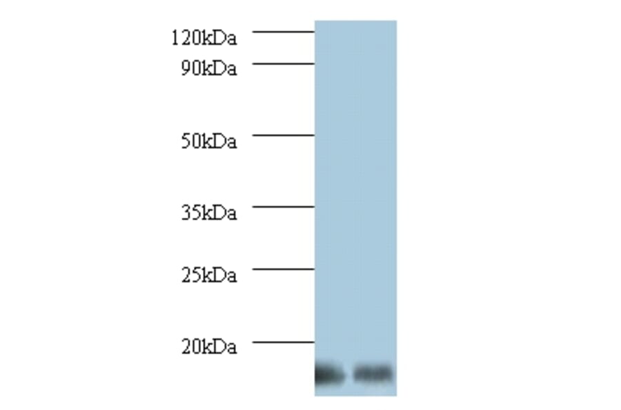 6.8 kDa mitochondrial proteolipid Polyclonal Antibody from Signalway Antibody (42146) - Antibodies.com