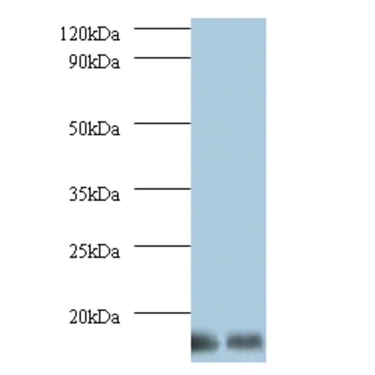 6.8 kDa mitochondrial proteolipid Polyclonal Antibody from Signalway Antibody (42146) - Antibodies.com