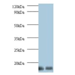 6.8 kDa mitochondrial proteolipid Polyclonal Antibody from Signalway Antibody (42146) - Antibodies.com