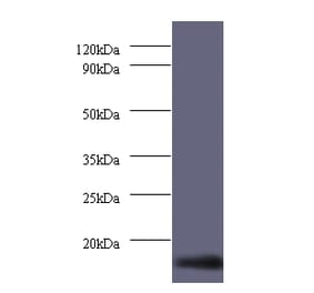 Dynein light chain 1, cytoplasmic Polyclonal Antibody from Signalway Antibody (42236) - Antibodies.com