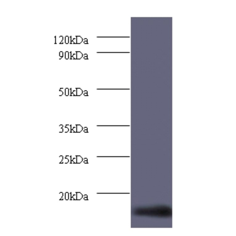 Dynein light chain 1, cytoplasmic Polyclonal Antibody from Signalway Antibody (42236) - Antibodies.com