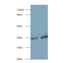 Small nuclear ribonucleoprotein G Polyclonal Antibody from Signalway Antibody (42264) - Antibodies.com
