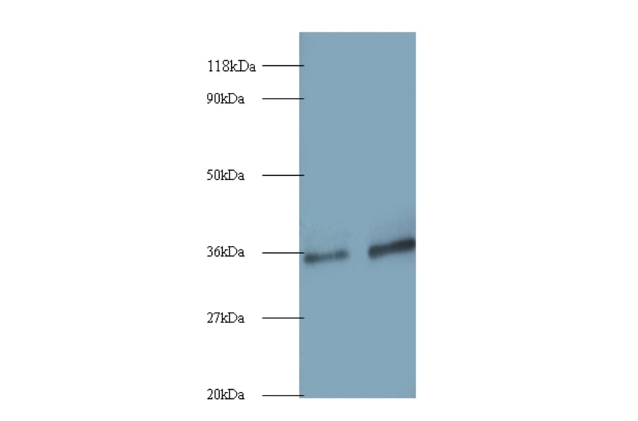 Small nuclear ribonucleoprotein G Polyclonal Antibody from Signalway Antibody (42264) - Antibodies.com