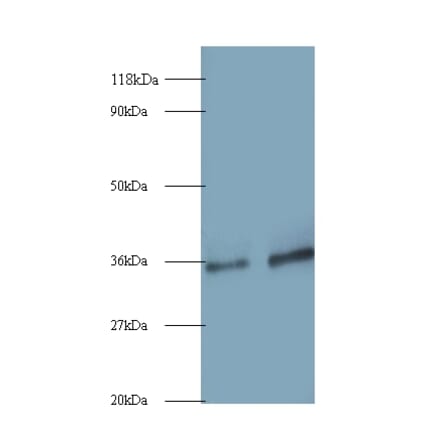 Small nuclear ribonucleoprotein G Polyclonal Antibody from Signalway Antibody (42264) - Antibodies.com