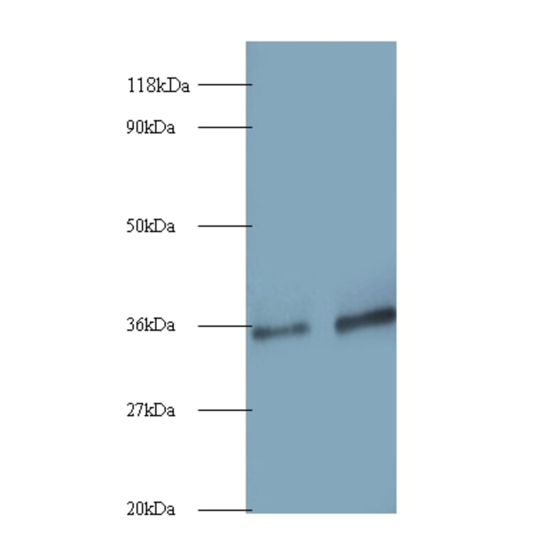 Small nuclear ribonucleoprotein G Polyclonal Antibody from Signalway Antibody (42264) - Antibodies.com
