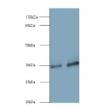 Small nuclear ribonucleoprotein G Polyclonal Antibody from Signalway Antibody (42264) - Antibodies.com