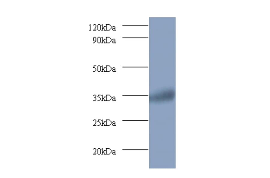 Ras-related GTP-binding protein A Polyclonal Antibody from Signalway Antibody (42394) - Antibodies.com