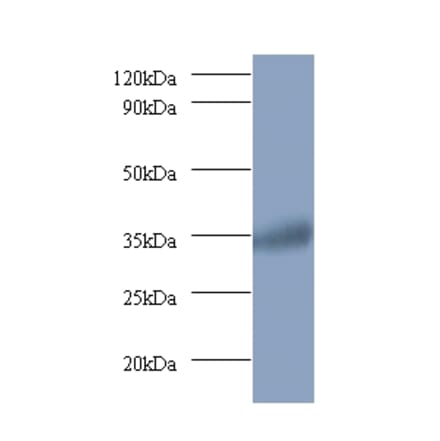 Ras-related GTP-binding protein A Polyclonal Antibody from Signalway Antibody (42394) - Antibodies.com