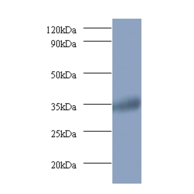 Ras-related GTP-binding protein A Polyclonal Antibody from Signalway Antibody (42394) - Antibodies.com
