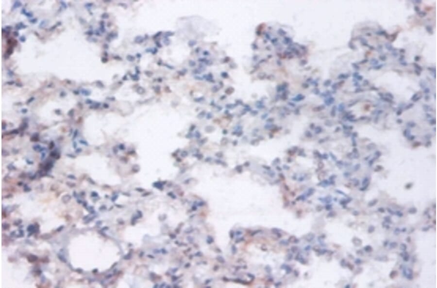 Immunohistochemistry - Ras-related GTP-binding protein A Polyclonal Antibody from Signalway Antibody (42394)