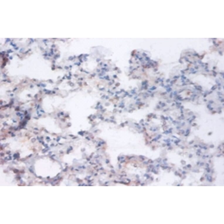 Immunohistochemistry - Ras-related GTP-binding protein A Polyclonal Antibody from Signalway Antibody (42394)