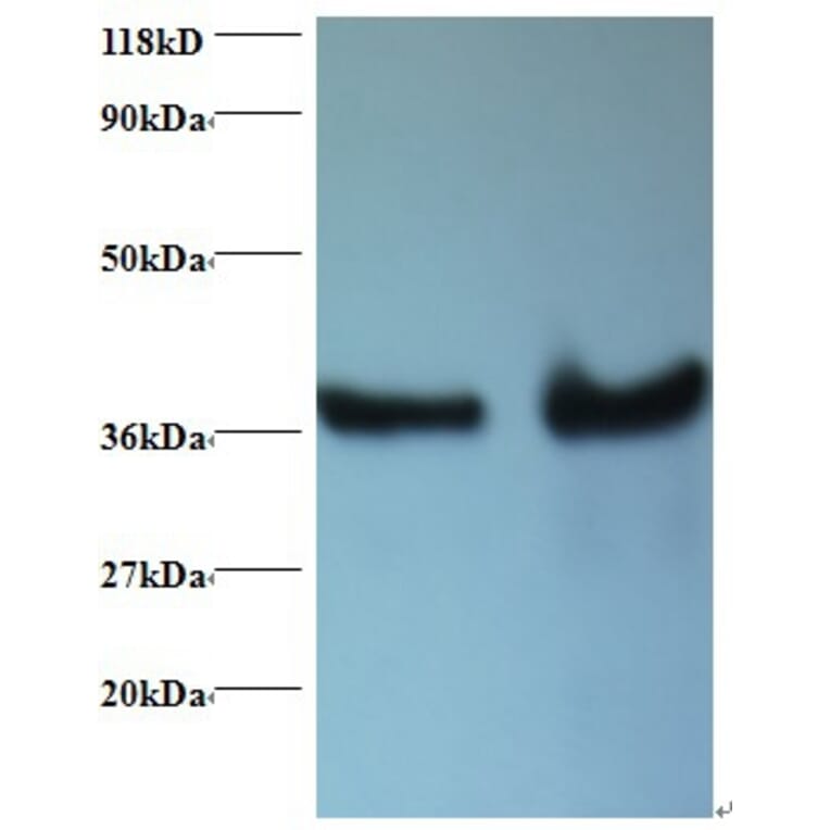 DnaJ homolog subfamily B member 1 Polyclonal Antibody from Signalway Antibody (42405) - Antibodies.com