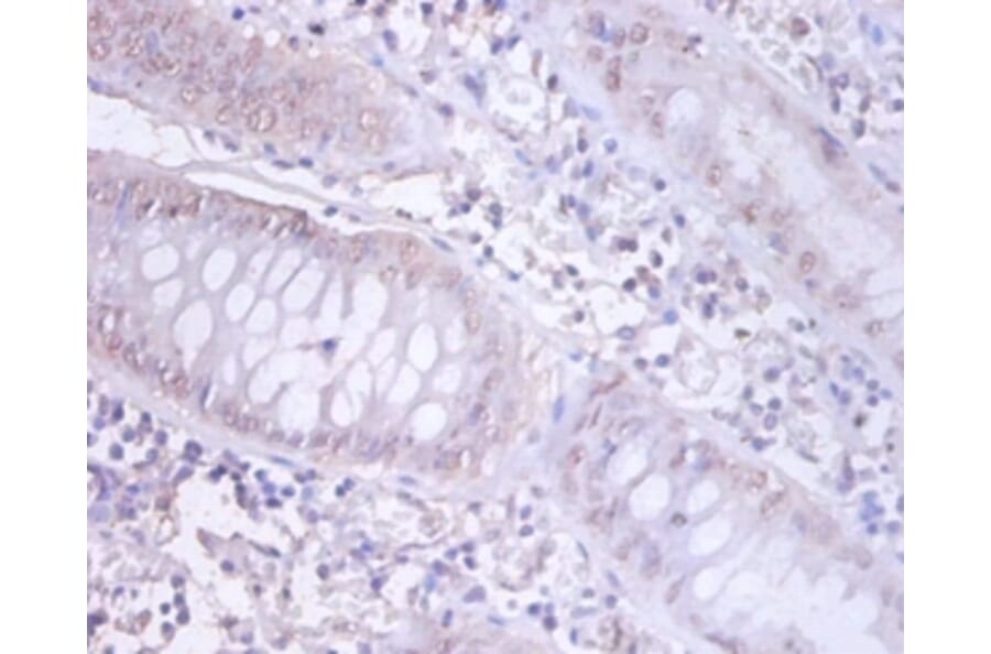 Immunohistochemistry - DnaJ homolog subfamily B member 1 Polyclonal Antibody from Signalway Antibody (42405)