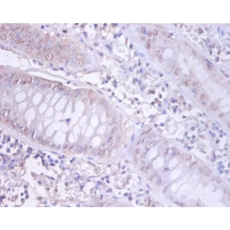 Immunohistochemistry - DnaJ homolog subfamily B member 1 Polyclonal Antibody from Signalway Antibody (42405)