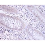 Immunohistochemistry - DnaJ homolog subfamily B member 1 Polyclonal Antibody from Signalway Antibody (42405)