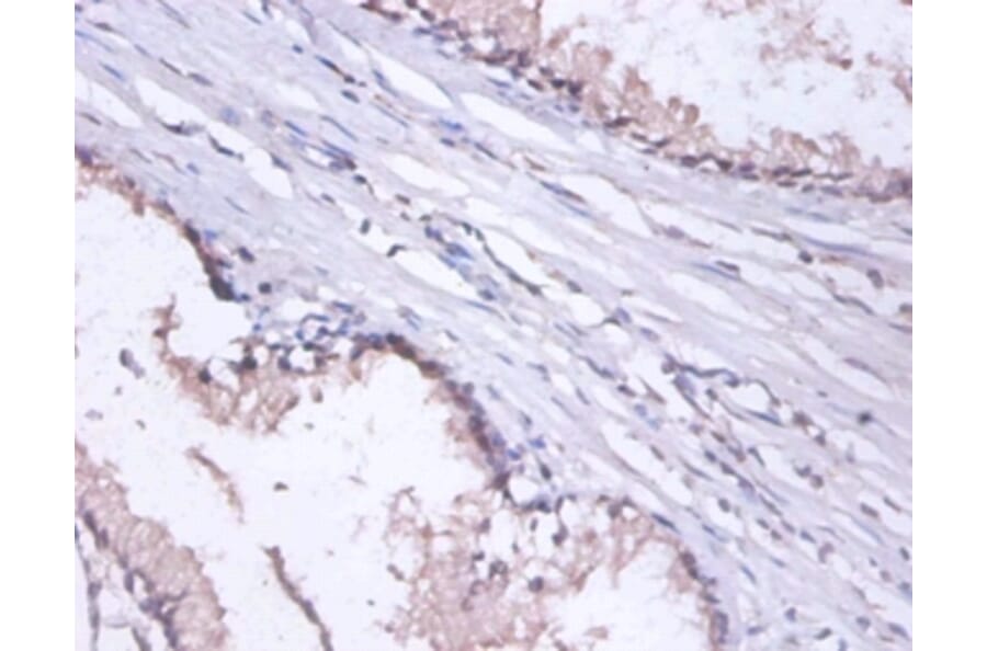Immunohistochemistry - DnaJ homolog subfamily B member 1 Polyclonal Antibody from Signalway Antibody (42405)