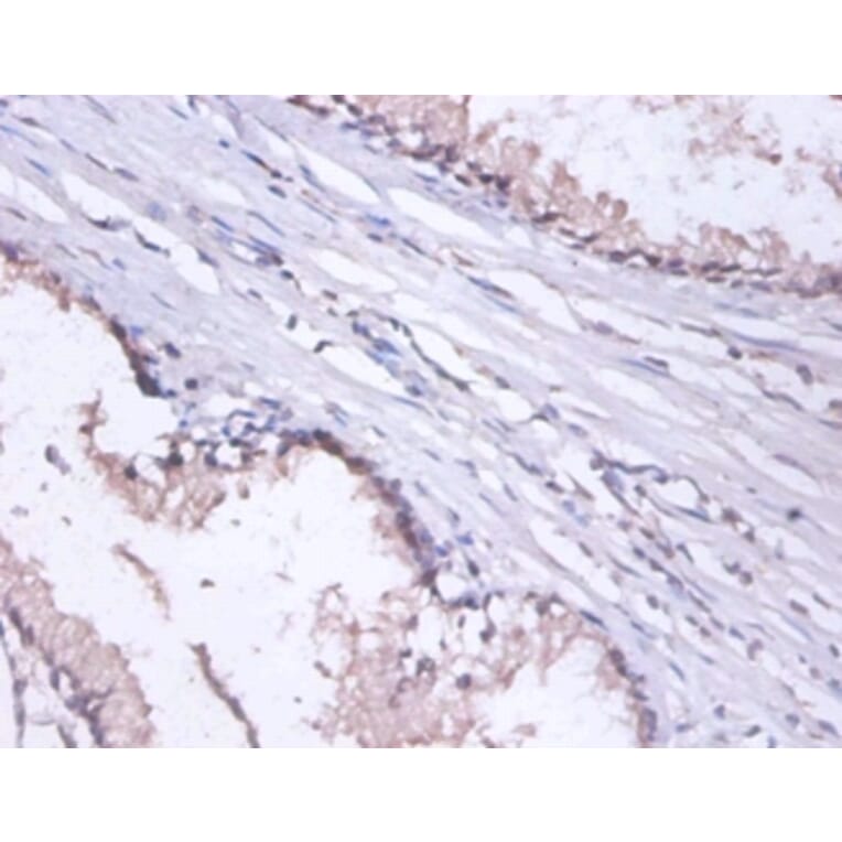Immunohistochemistry - DnaJ homolog subfamily B member 1 Polyclonal Antibody from Signalway Antibody (42405)