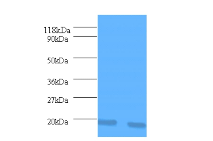 Interleukin-1 receptor antagonist Polyclonal Antibody from Signalway Antibody (42463) - Antibodies.com