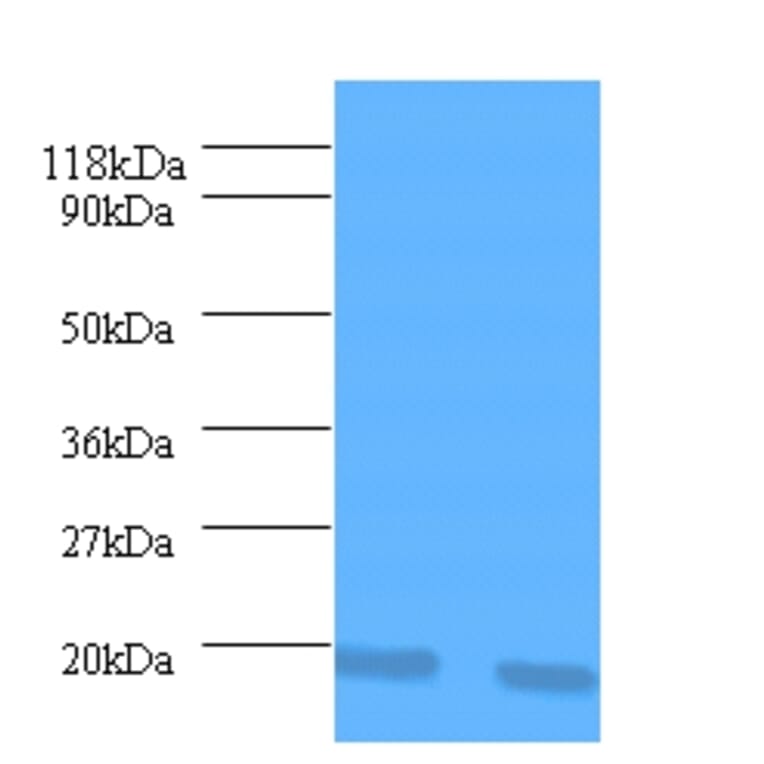 Interleukin-1 receptor antagonist Polyclonal Antibody from Signalway Antibody (42463) - Antibodies.com