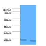 Interleukin-1 receptor antagonist Polyclonal Antibody from Signalway Antibody (42463) - Antibodies.com