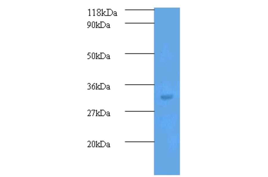 Transforming growth factor beta-2 Polyclonal Antibody from Signalway Antibody (42481) - Antibodies.com