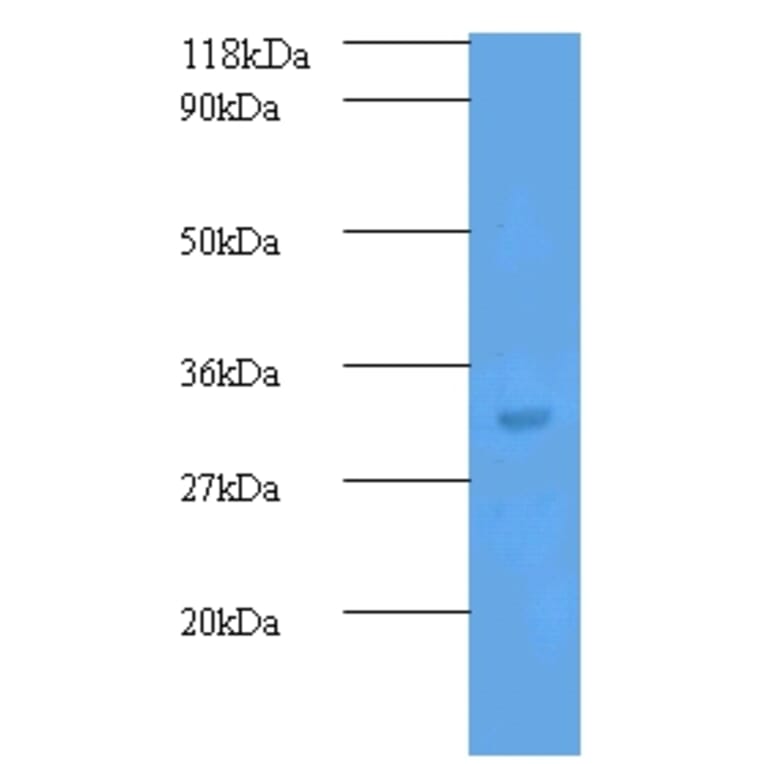 Transforming growth factor beta-2 Polyclonal Antibody from Signalway Antibody (42481) - Antibodies.com