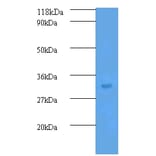 Transforming growth factor beta-2 Polyclonal Antibody from Signalway Antibody (42481) - Antibodies.com
