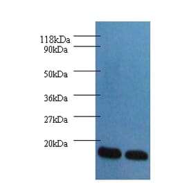 Fatty acid-binding protein, heart Polyclonal Antibody from Signalway Antibody (42492) - Antibodies.com