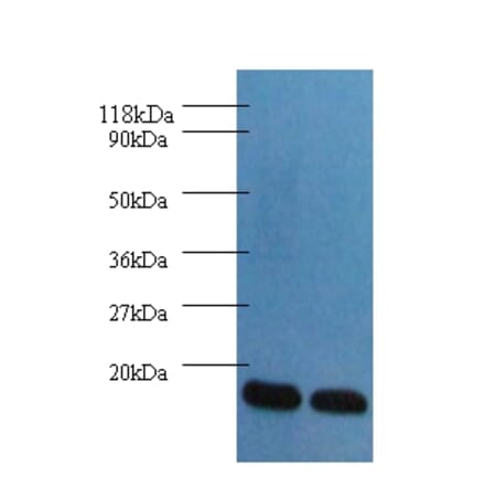 Fatty acid-binding protein, heart Polyclonal Antibody from Signalway Antibody (42492) - Antibodies.com