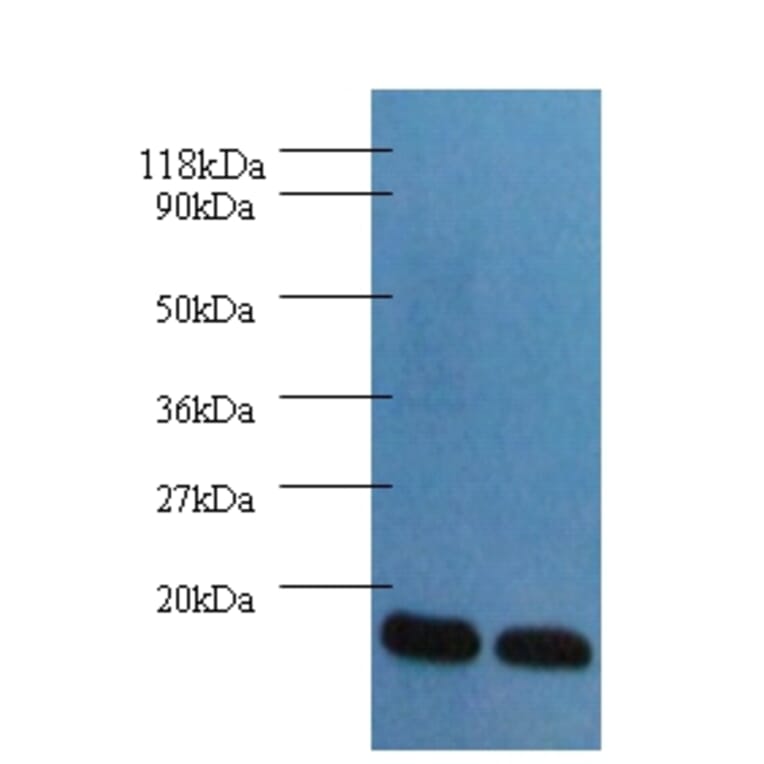Fatty acid-binding protein, heart Polyclonal Antibody from Signalway Antibody (42492) - Antibodies.com