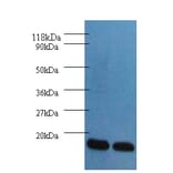 Fatty acid-binding protein, heart Polyclonal Antibody from Signalway Antibody (42492) - Antibodies.com