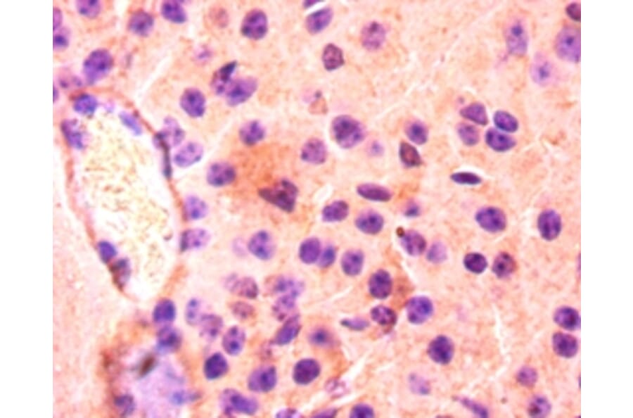 Immunohistochemistry - Fatty acid-binding protein, heart Polyclonal Antibody from Signalway Antibody (42492)