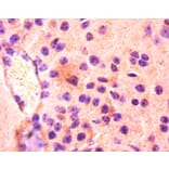Immunohistochemistry - Fatty acid-binding protein, heart Polyclonal Antibody from Signalway Antibody (42492)