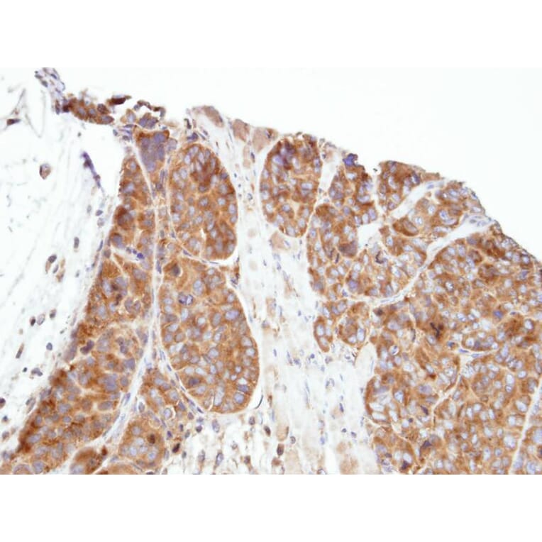 Immunohistochemistry - PRPP synthetase-associated protein 1 antibody from Signalway Antibody - Antibodies.com