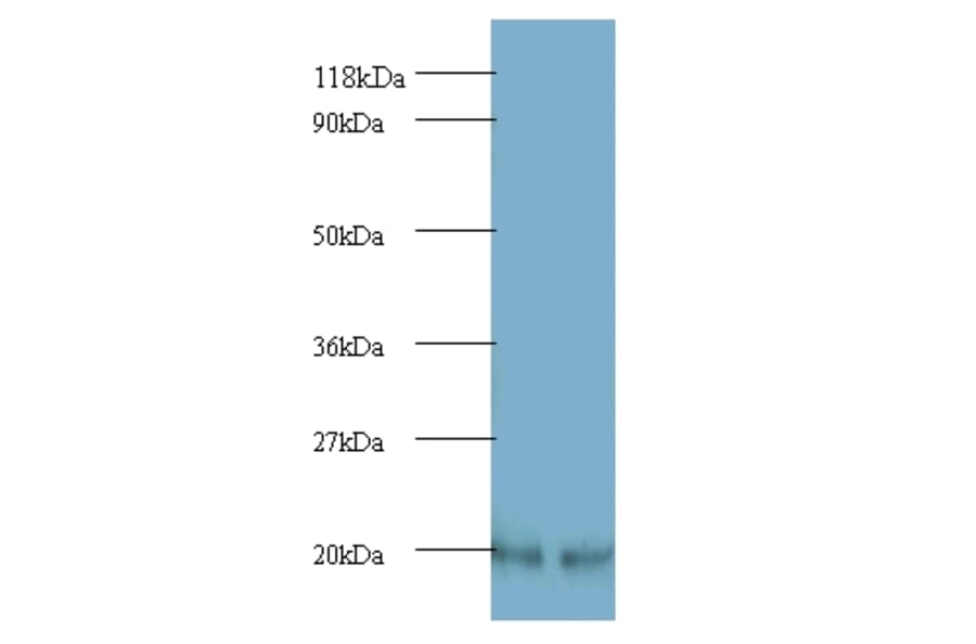 ADP-ribosylation factor 4 Polyclonal Antibody from Signalway Antibody (42173) - Antibodies.com