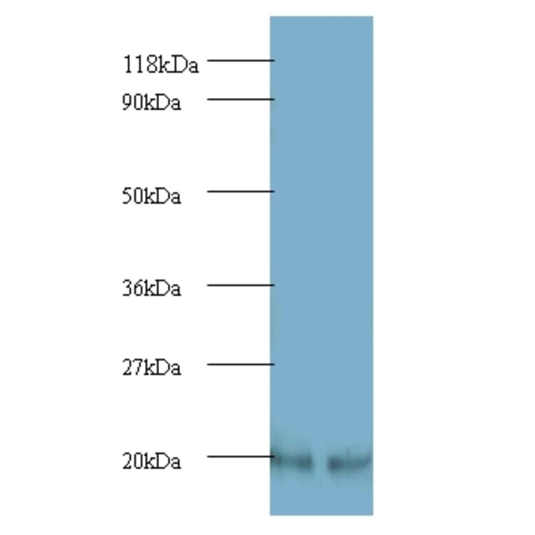 ADP-ribosylation factor 4 Polyclonal Antibody from Signalway Antibody (42173) - Antibodies.com